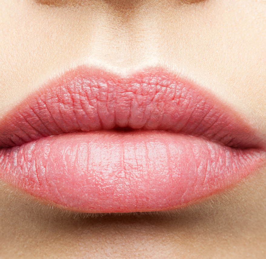 pink-lips-after-treatment-with-restylane-kysse