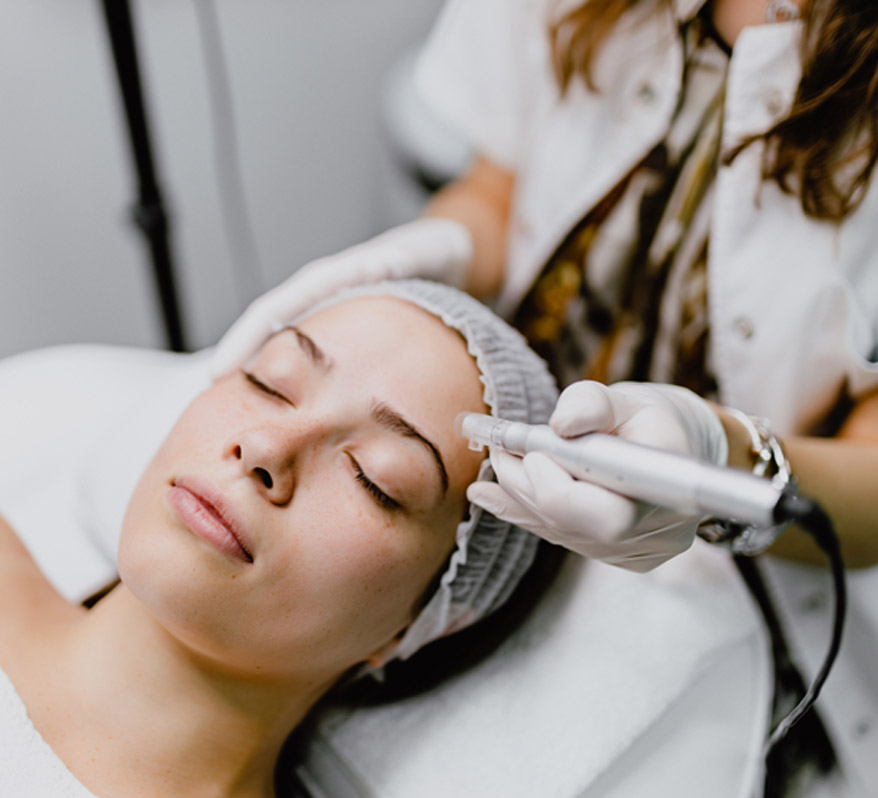 woman-undergoing-microneedling-treatment-in-beauty-clinic