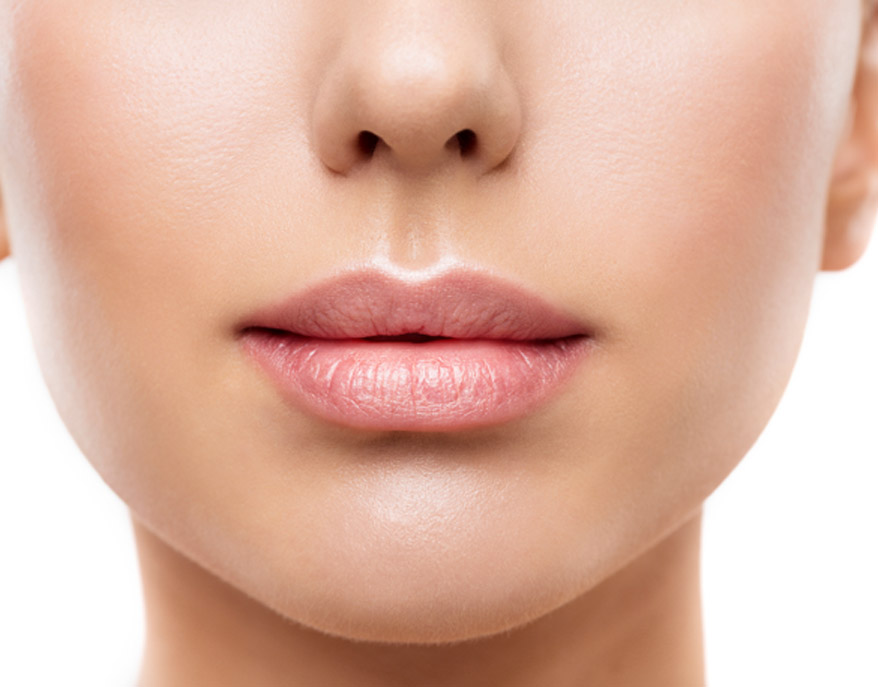 womans-smile-lines-treated-with-juvederm-xc