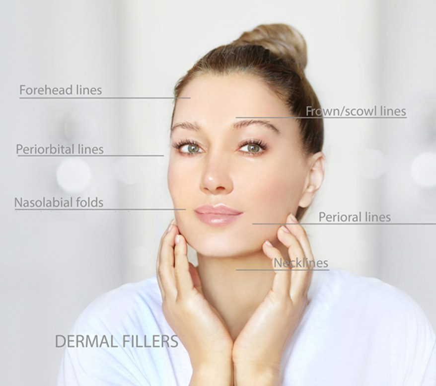 illustration-of-cosmetic-concerns-that-can-be-treated-with-botox