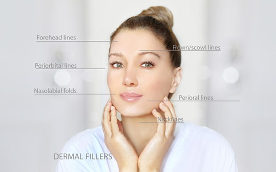 illustration-of-types-of-wrinkles-treated-by-dermal-fillers-such-as-botox